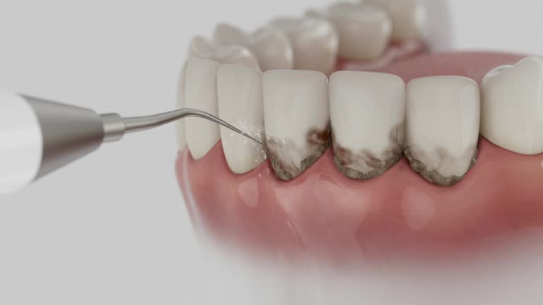 Reliable Dental Implants contractor in Cleveland, OH by Smile Center Dentistry